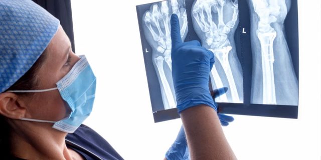 osteosintesis